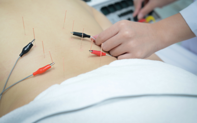 Jump Starting the Body with Electroacupuncture